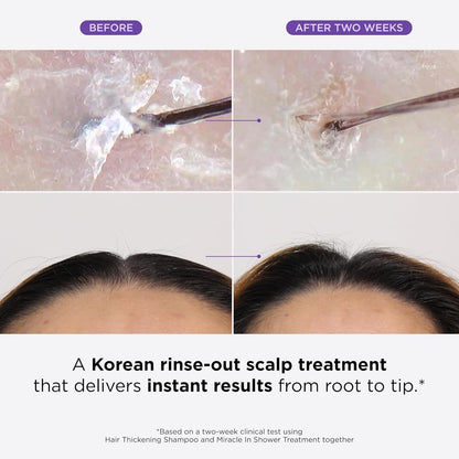 Dr. Groot Thickening Shampoo & Scalp Treatment Set for Hair Loss